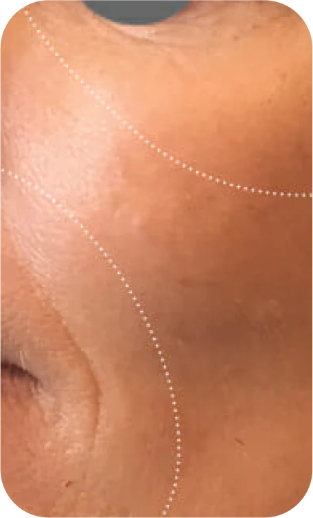 Mask_group_after_young